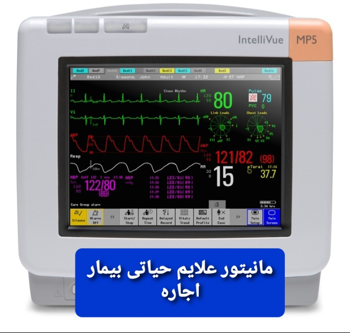 اجاره مانیتورینگ